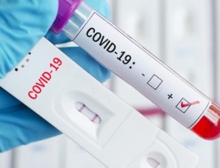 2610 нови случая на COVID 19 са регистрирани у нас за